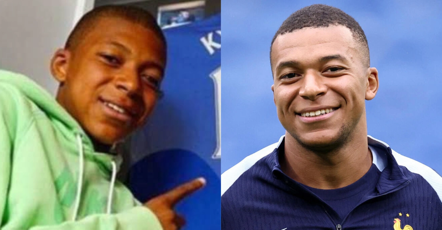 Kylian Mbappé before and after